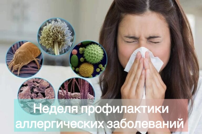 Неделя профилактики аллергических заболеваний